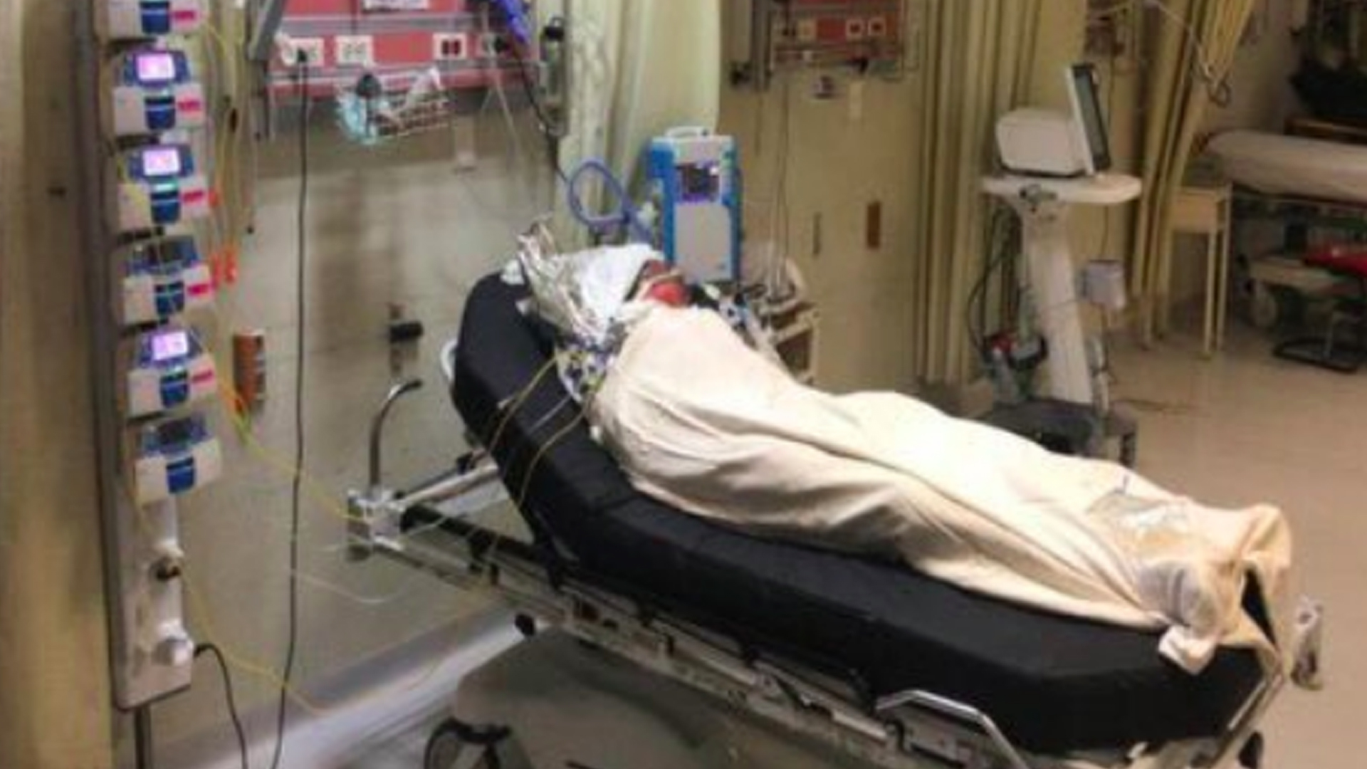 Reciben tratamiento en Texas dos menores que sufrieron quemaduras