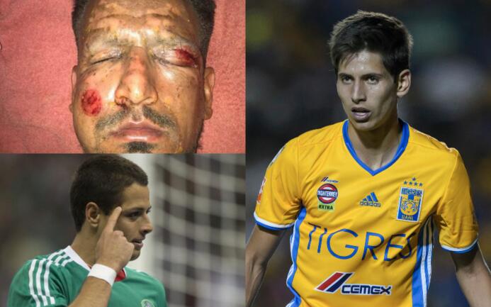 Las lesiones más insólitas del fútbol mundial lesiones-insolitas.jpg