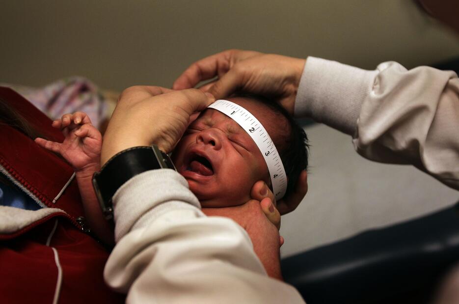 salud virus del zika