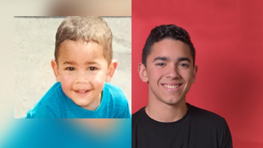 francobeforeandafter